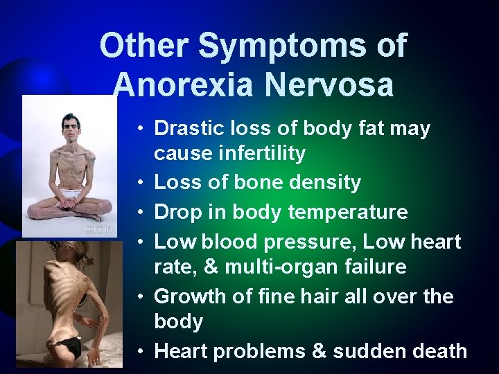 Other Symptoms of Anorexia Nervosa • Drastic loss of body fat may cause infertility