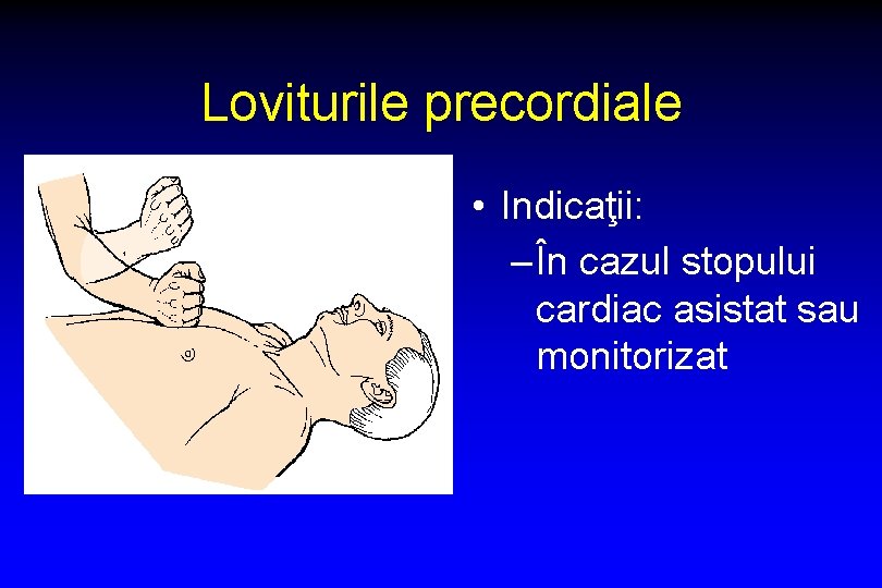 Loviturile precordiale • Indicaţii: – În cazul stopului cardiac asistat sau monitorizat 