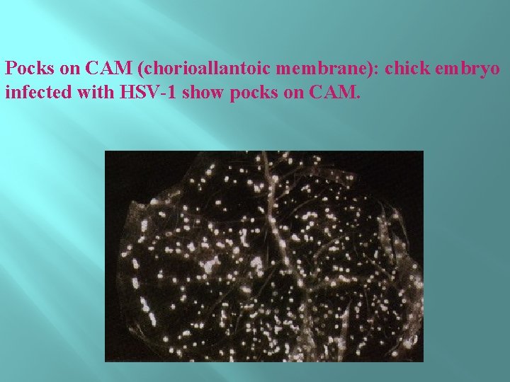 Pocks on CAM (chorioallantoic membrane): chick embryo infected with HSV-1 show pocks on CAM.