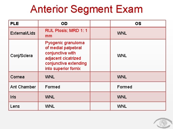 Anterior Segment Exam PLE OD OS External/Lids RUL Ptosis; MRD 1: 1 mm WNL