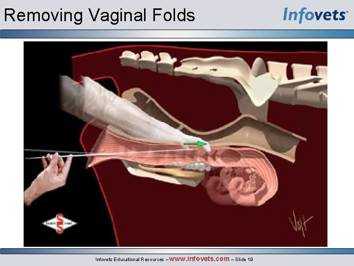 Removing Vaginal Folds Infovets Educational Resources – www. infovets. com – Slide 19 