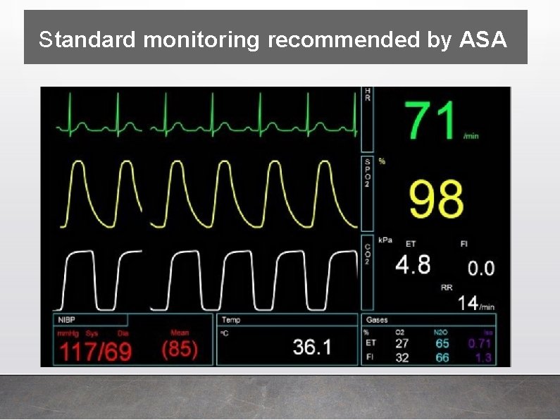 Standard monitoring recommended by ASA 