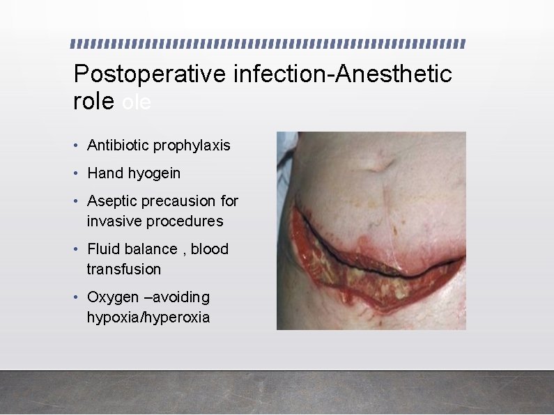 Postoperative infection-Anesthetic role • Antibiotic prophylaxis • Hand hyogein • Aseptic precausion for invasive