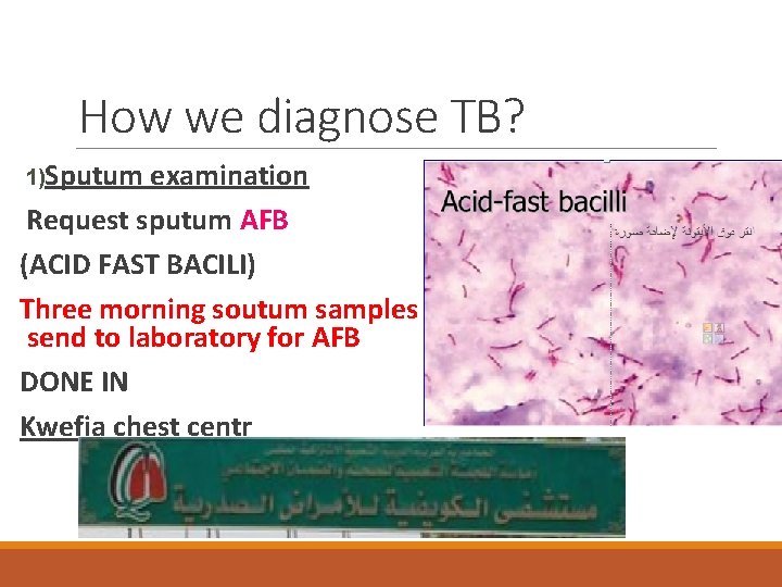 How we diagnose TB? 1)Sputum examination Request sputum AFB (ACID FAST BACILI) Three morning