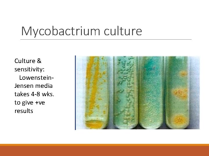 Mycobactrium culture Culture & sensitivity: Lowenstein. Jensen media takes 4 -8 wks. to give