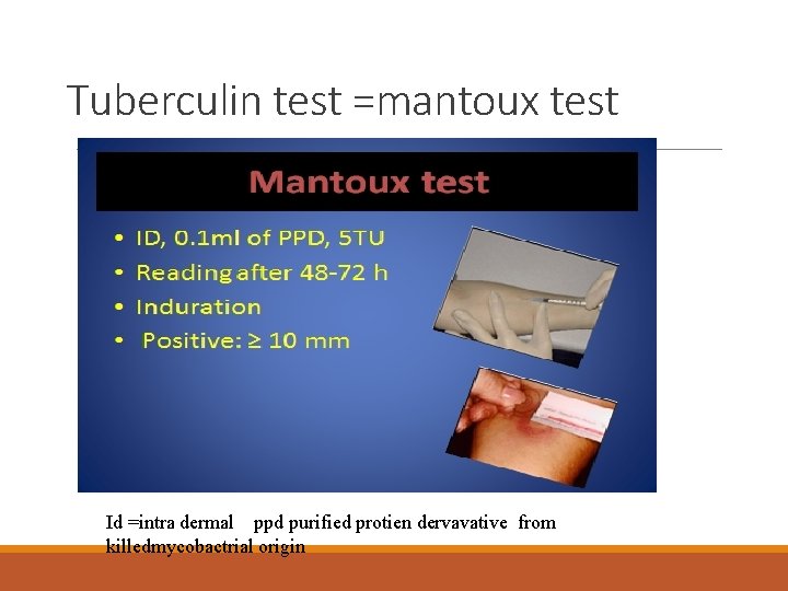 Tuberculin test =mantoux test Id =intra dermal ppd purified protien dervavative from killedmycobactrial origin