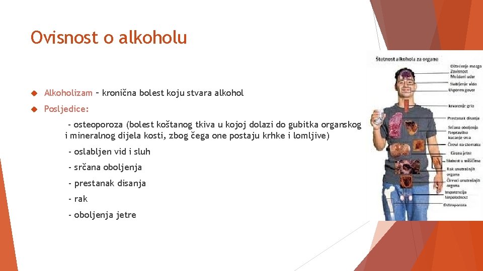 Ovisnost o alkoholu Alkoholizam – kronična bolest koju stvara alkohol Posljedice: - osteoporoza (bolest Ovisnost o alkoholu Alkoholizam – kronična bolest koju stvara alkohol Posljedice: - osteoporoza (bolest