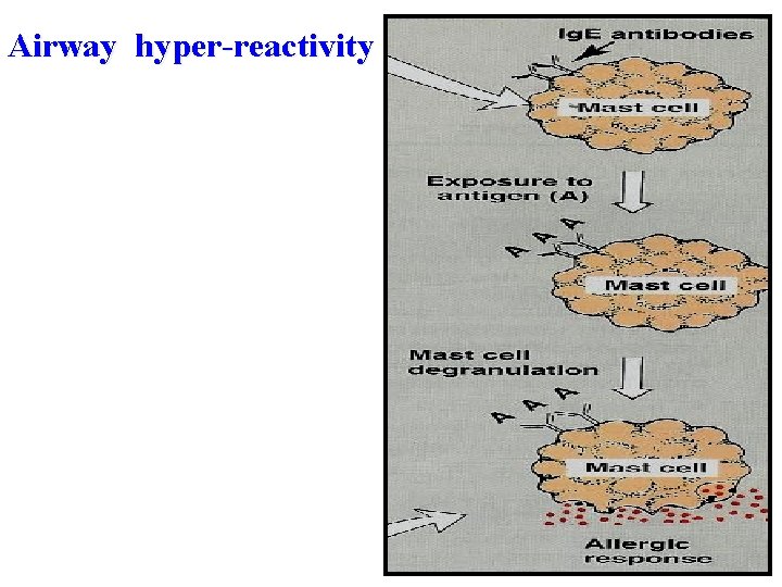 Airway hyper-reactivity 