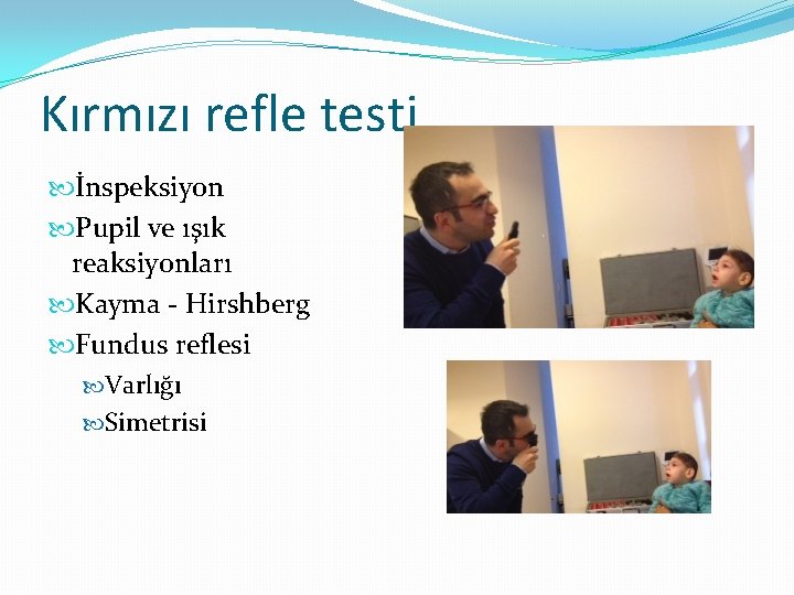 Kırmızı refle testi İnspeksiyon Pupil ve ışık reaksiyonları Kayma - Hirshberg Fundus reflesi Varlığı