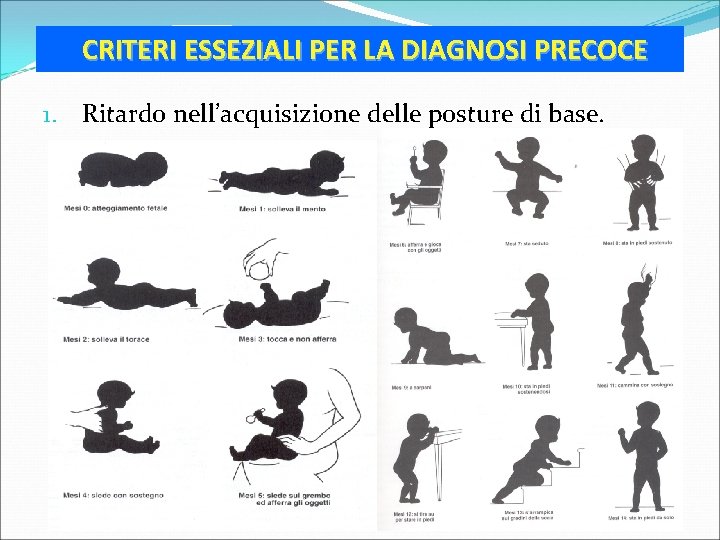 CRITERI ESSEZIALI PER LA DIAGNOSI PRECOCE 1. Ritardo nell’acquisizione delle posture di base. 