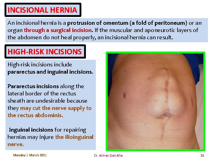 INCISIONAL HERNIA An incisional hernia is a protrusion of omentum (a fold of peritoneum)