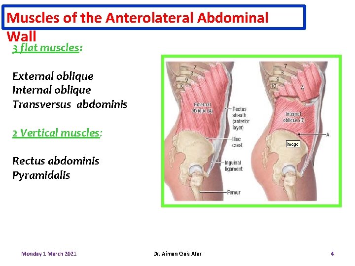 Muscles of the Anterolateral Abdominal Wall 3 flat muscles: External oblique Internal oblique Transversus