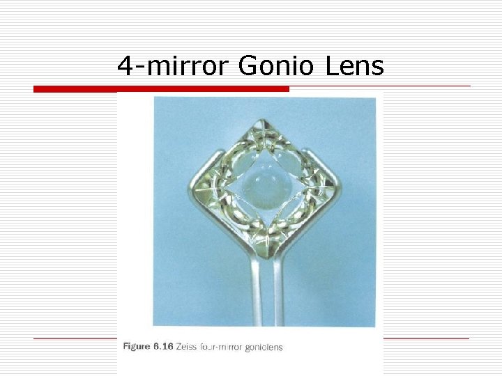 4 -mirror Gonio Lens 