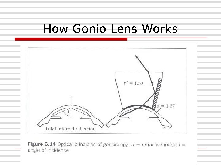 How Gonio Lens Works 
