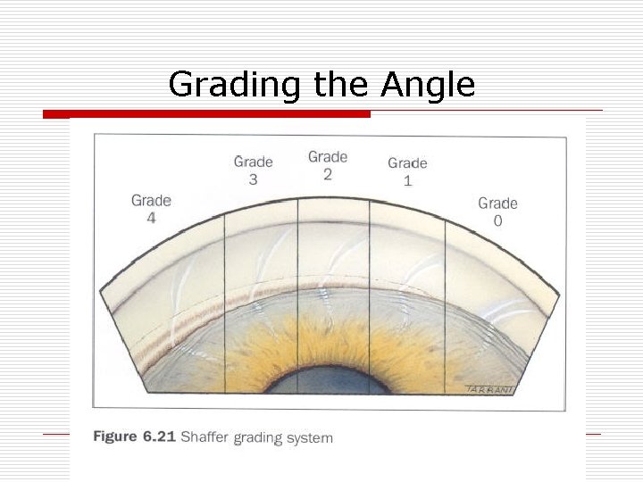 Grading the Angle 