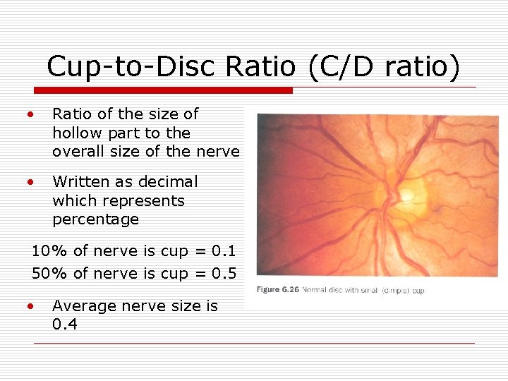 Cup-to-Disc Ratio (C/D ratio) • Ratio of the size of hollow part to the
