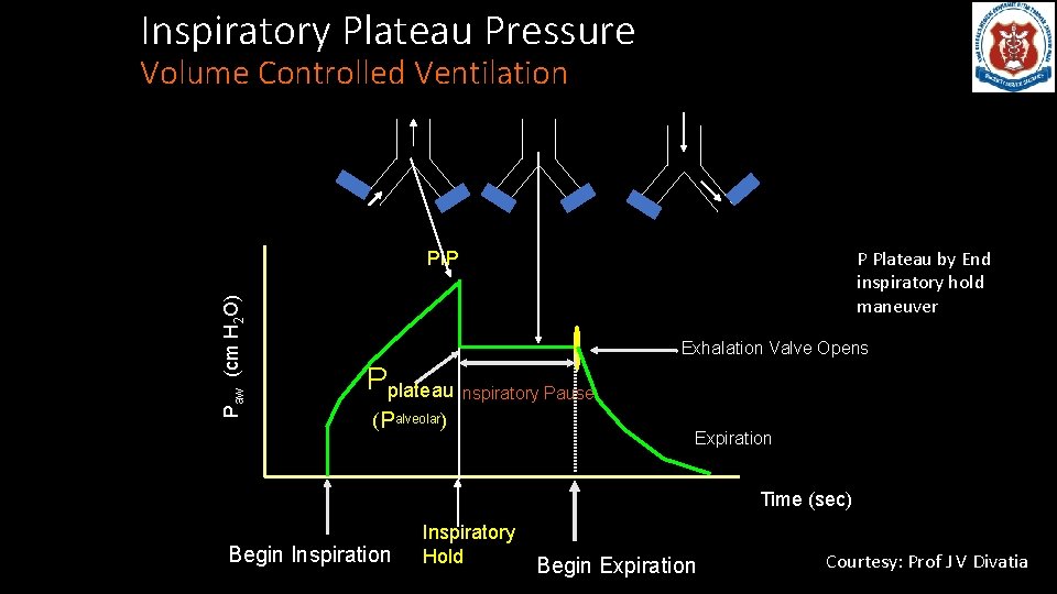 Inspiratory Plateau Pressure Volume Controlled Ventilation P Plateau by End inspiratory hold maneuver Paw