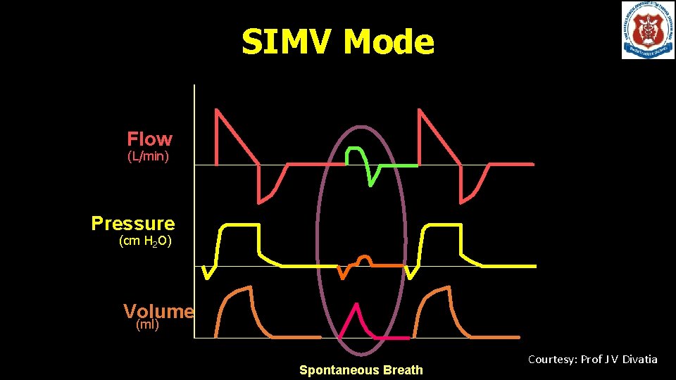 SIMV Mode Flow (L/min) Pressure (cm H 2 O) Volume (ml) Time (sec) Spontaneous