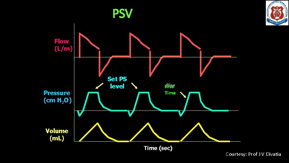 PSV Flow (L/m) Pressure (cm H 2 O) Set PS level Rise Time Volume