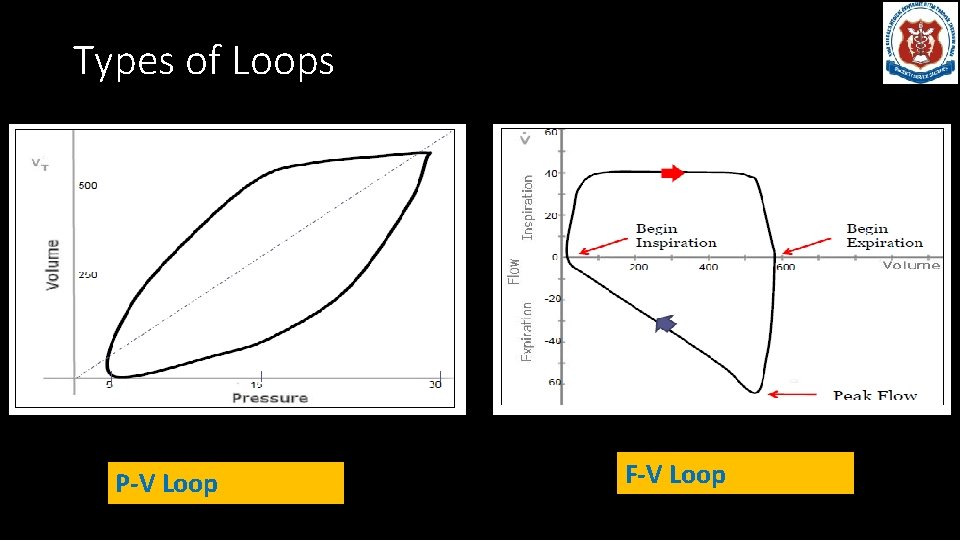 Types of Loops P-V Loop F-V Loop 