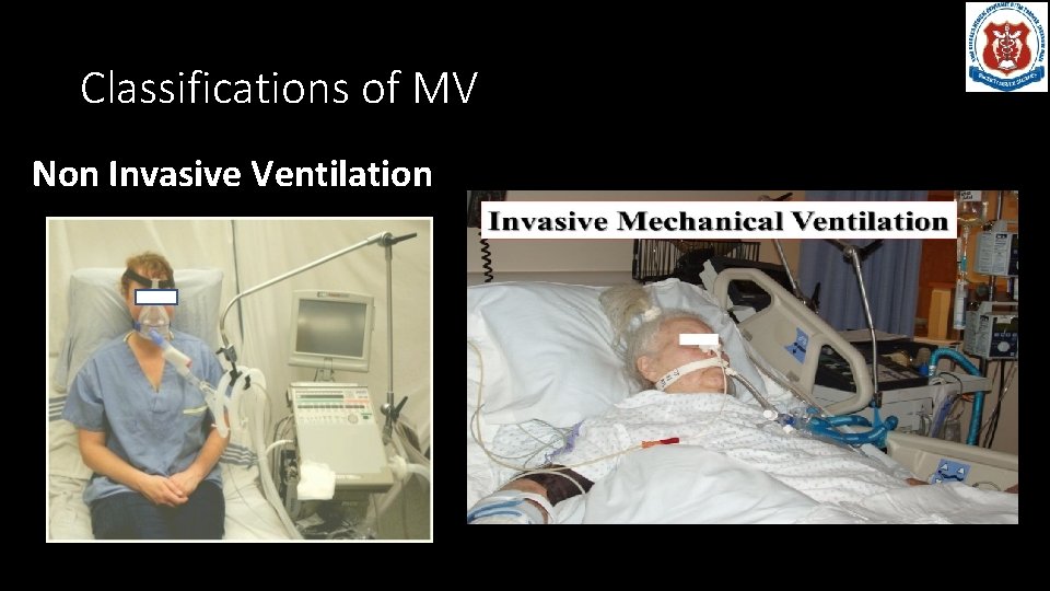Classifications of MV Non Invasive Ventilation 