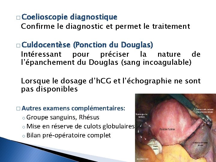 � Coelioscopie diagnostique Confirme le diagnostic et permet le traitement � Culdocentèse (Ponction du