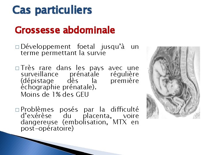 Cas particuliers Grossesse abdominale � Développement foetal jusqu’à un terme permettant la survie �