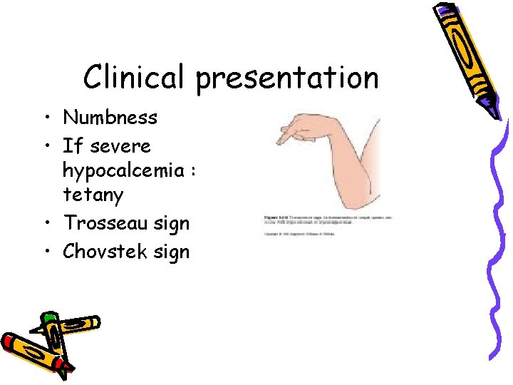 Clinical presentation • Numbness • If severe hypocalcemia : tetany • Trosseau sign •