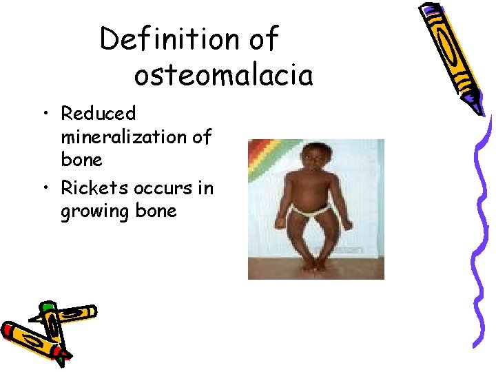 Definition of osteomalacia • Reduced mineralization of bone • Rickets occurs in growing bone