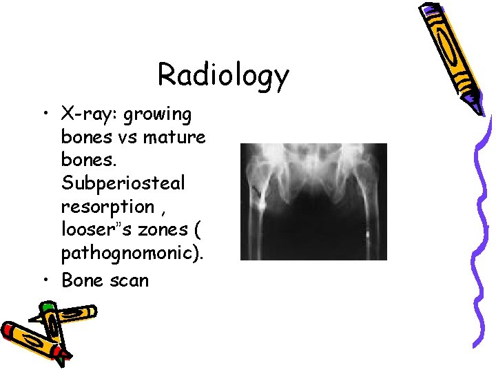 Radiology • X-ray: growing bones vs mature bones. Subperiosteal resorption , looser”s zones (