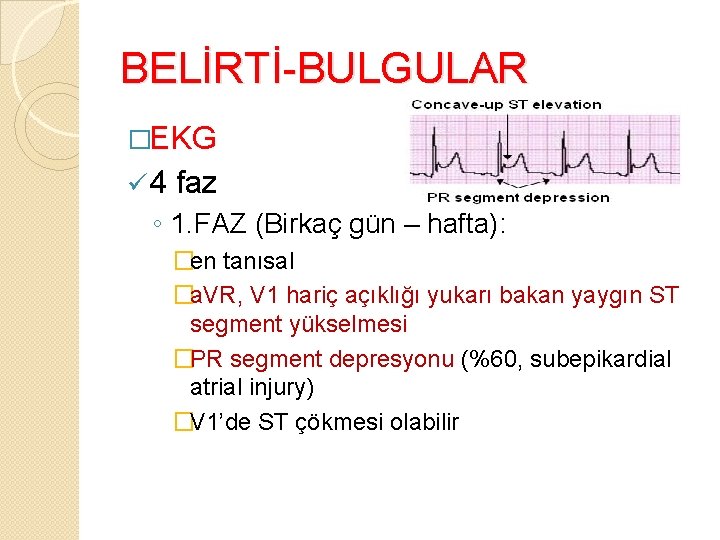 BELİRTİ-BULGULAR �EKG ü 4 faz ◦ 1. FAZ (Birkaç gün – hafta): �en tanısal