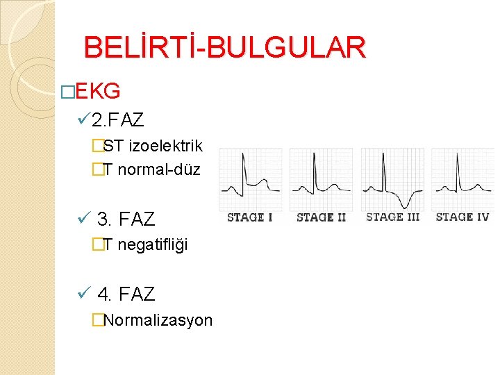 BELİRTİ-BULGULAR �EKG ü 2. FAZ �ST izoelektrik �T normal-düz ü 3. FAZ �T negatifliği