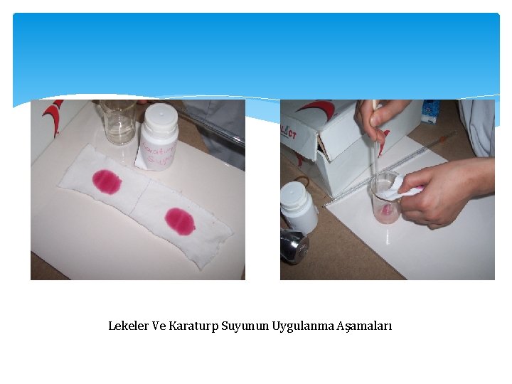 Lekeler Ve Karaturp Suyunun Uygulanma Aşamaları 