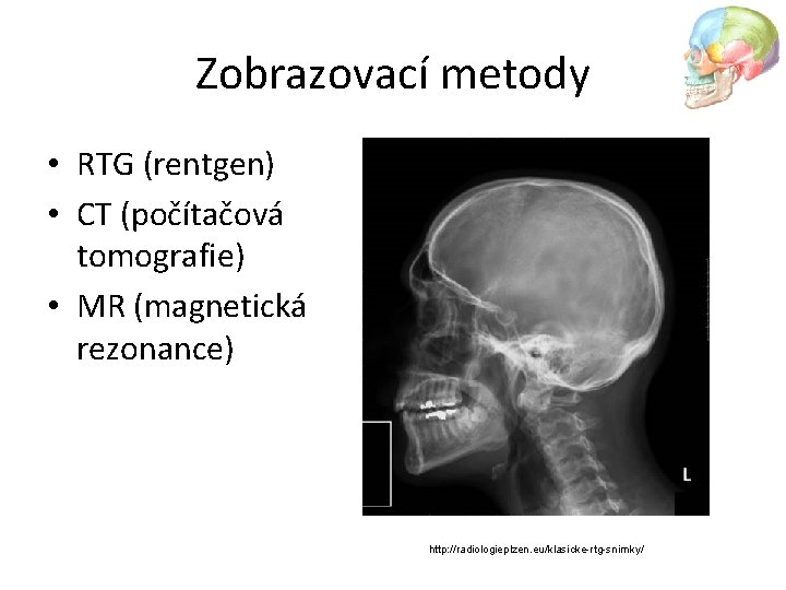 Zobrazovací metody • RTG (rentgen) • CT (počítačová tomografie) • MR (magnetická rezonance) http: