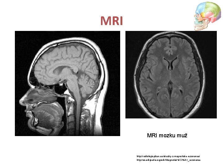 MRI mozku muž http: //radiologieplzen. eu/ukazky-z-magneticke-rezonance/ http: //cs. wikipedia. org/wiki/Magnetick%C 3%A 1_rezonance 