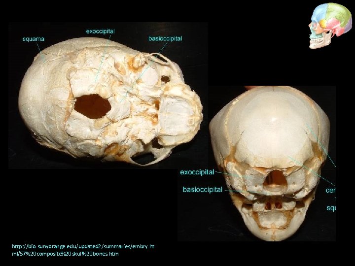 http: //bio. sunyorange. edu/updated 2/summaries/embry. ht ml/57%20 composite%20 skull%20 bones. htm 