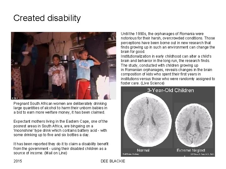 Created disability Until the 1990 s, the orphanages of Romania were notorious for their