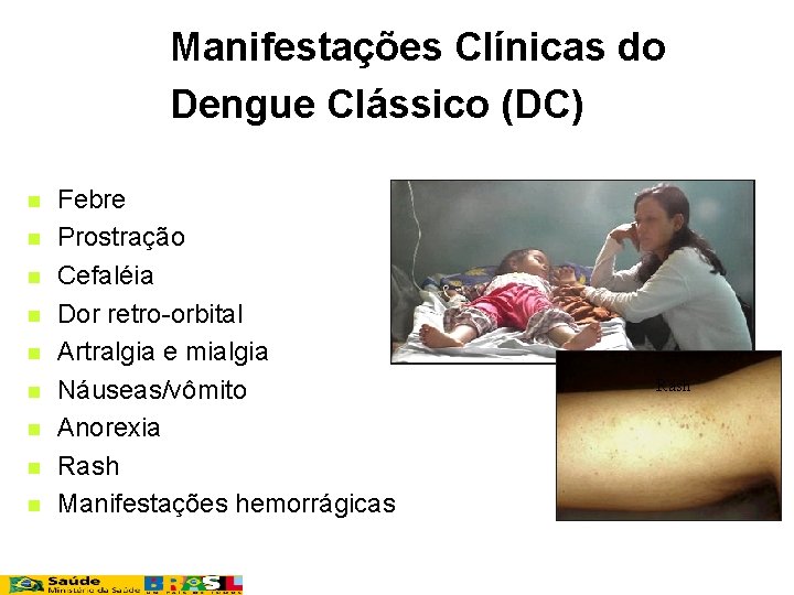 Manifestações Clínicas do Dengue Clássico (DC) n n n n n Febre Prostração Cefaléia