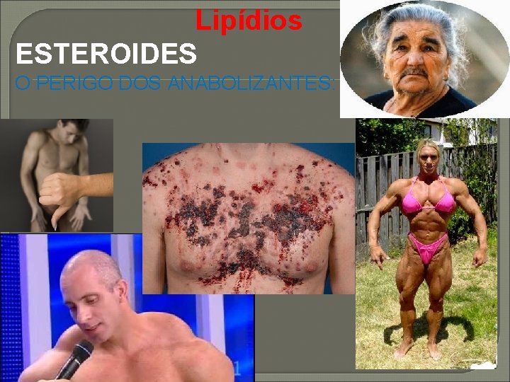 Lipídios ESTEROIDES O PERIGO DOS ANABOLIZANTES: 