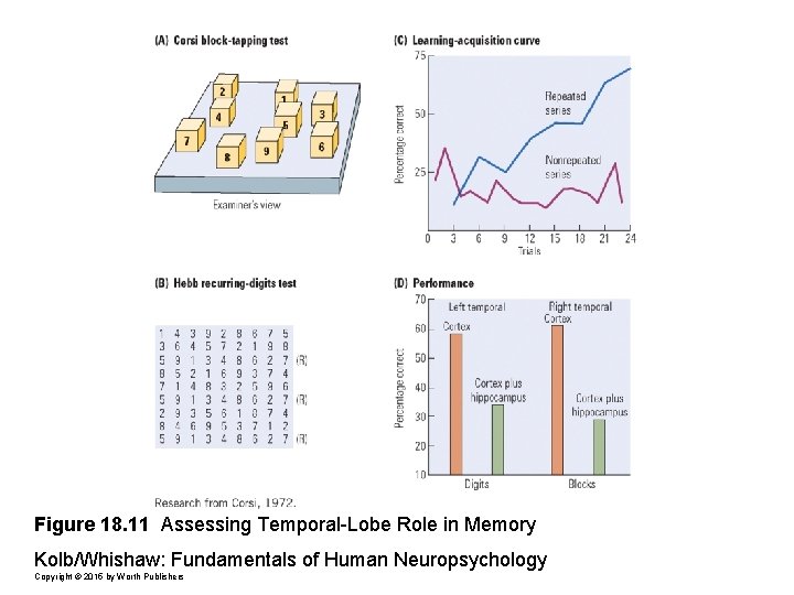Figure 18. 11 Assessing Temporal-Lobe Role in Memory Kolb/Whishaw: Fundamentals of Human Neuropsychology Copyright