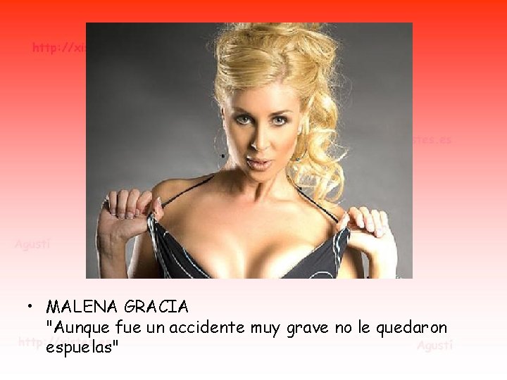 • MALENA GRACIA "Aunque fue un accidente muy grave no le quedaron espuelas" • MALENA GRACIA "Aunque fue un accidente muy grave no le quedaron espuelas"