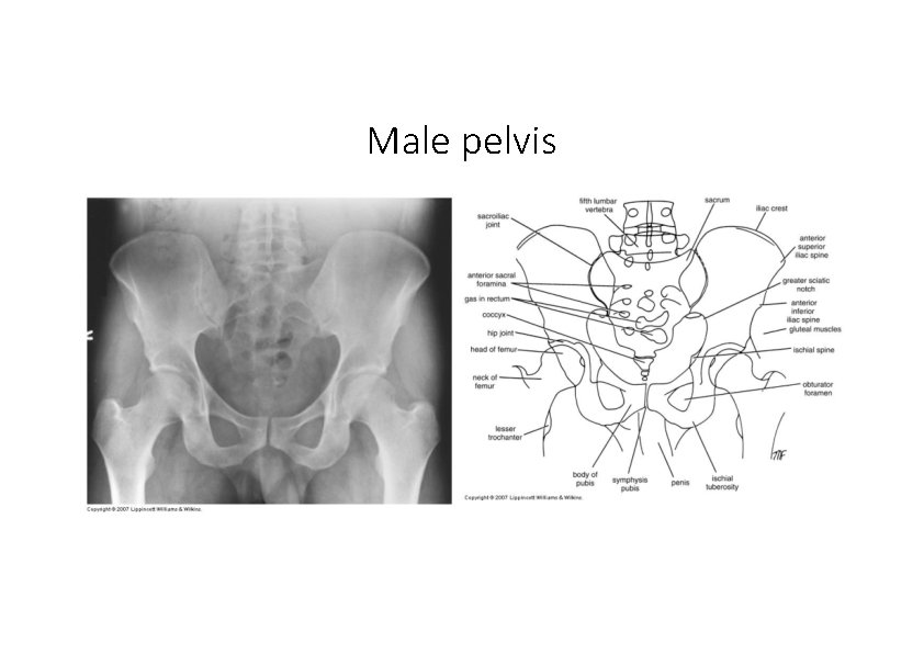 Male pelvis 