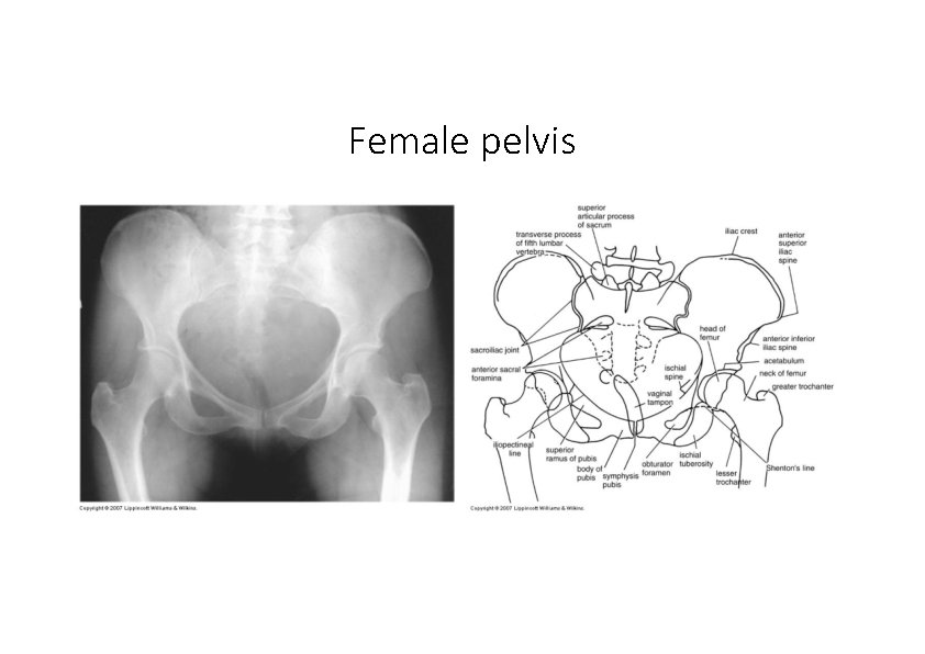 Female pelvis 