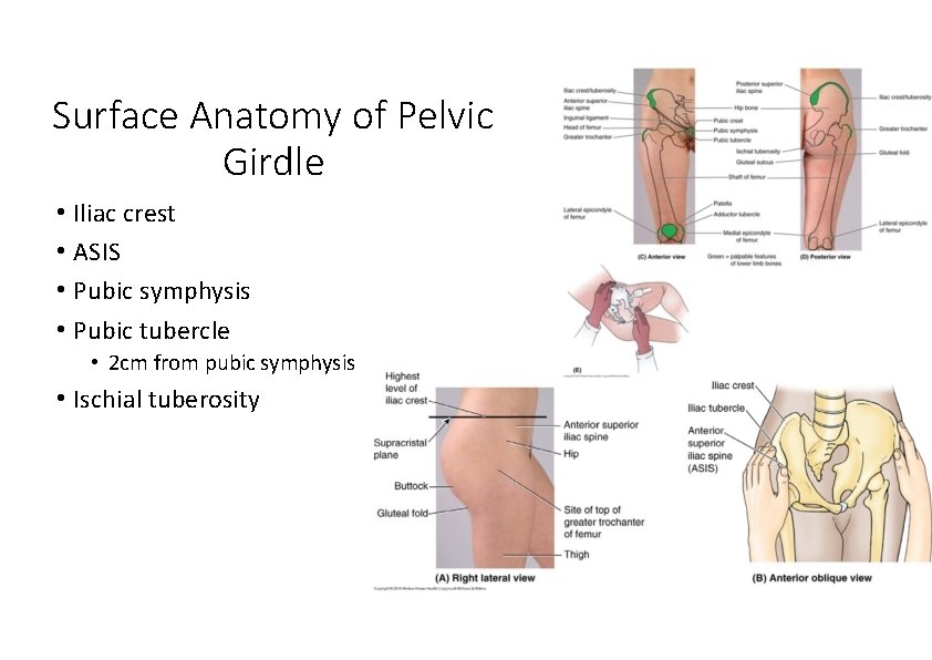 Surface Anatomy of Pelvic Girdle • Iliac crest • ASIS • Pubic symphysis •