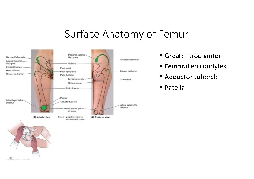 Surface Anatomy of Femur • Greater trochanter • Femoral epicondyles • Adductor tubercle •