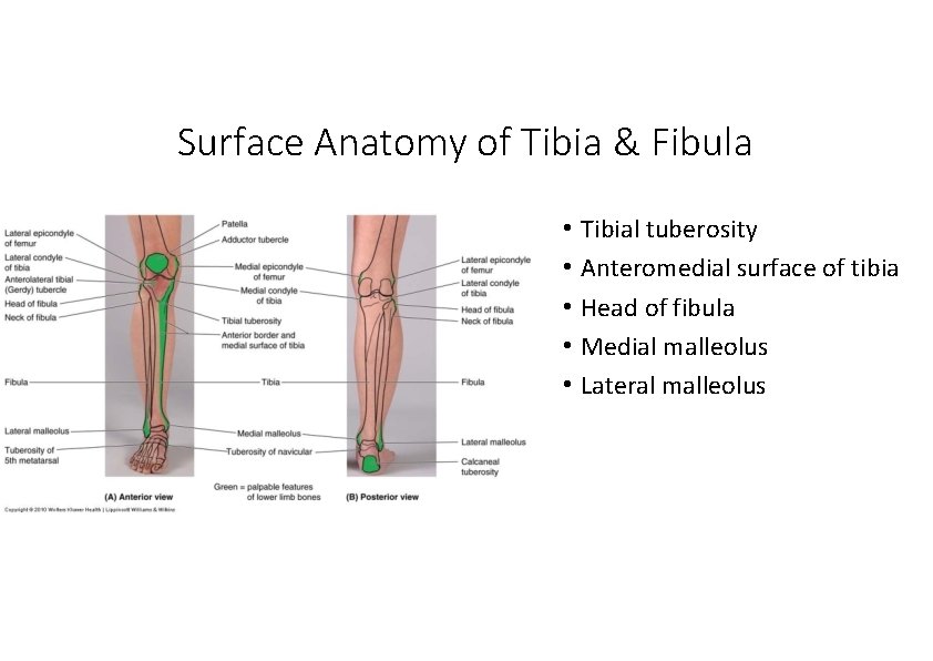Surface Anatomy of Tibia & Fibula • Tibial tuberosity • Anteromedial surface of tibia