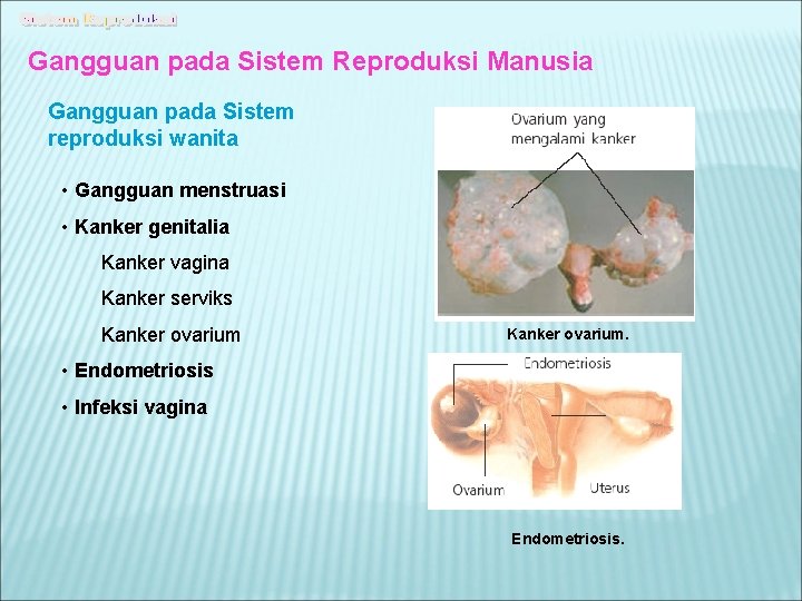 Gangguan pada Sistem Reproduksi Manusia Gangguan pada Sistem reproduksi wanita • Gangguan menstruasi •