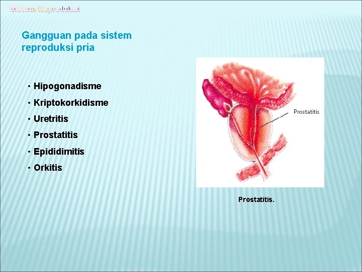 Gangguan pada sistem reproduksi pria • Hipogonadisme • Kriptokorkidisme • Uretritis • Prostatitis •