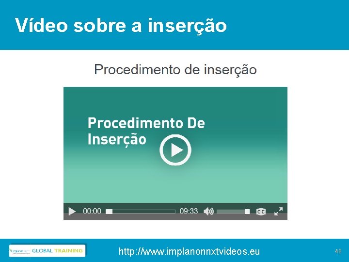 Vídeo sobre a inserção http: //www. implanonnxtvideos. eu 48 