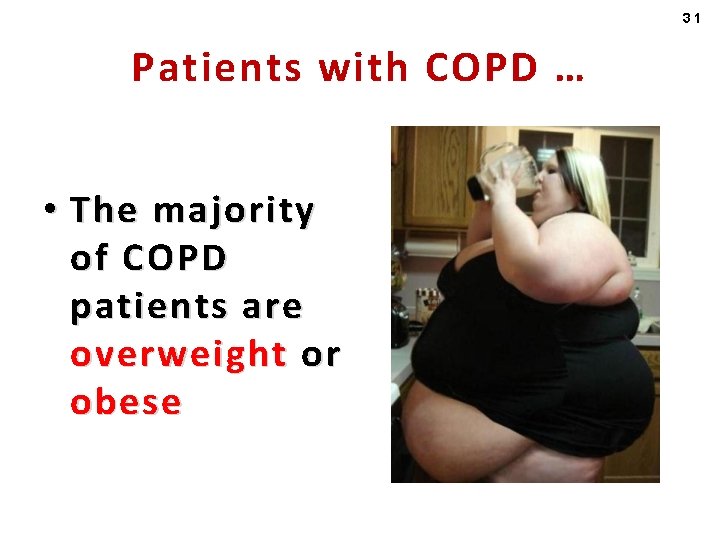 31 Patients with COPD … • The majority of COPD patients are overweight or